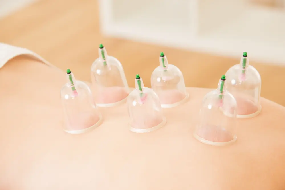 sportmassage zwolle Massage-cupping